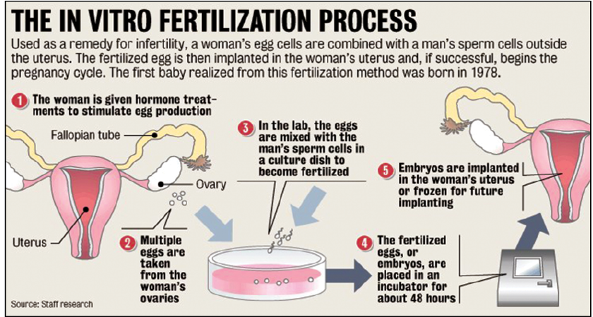 The In Vitro Fertilization Process